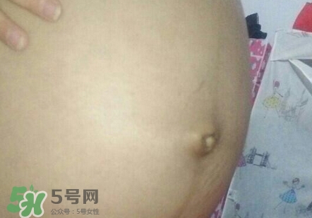 产后肚脐眼臭怎么办,产后肚脐眼臭怎么回事