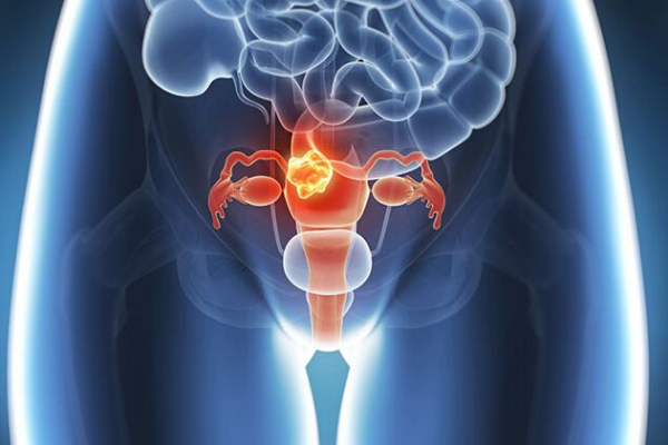 什么原因导致卵巢早衰呢,女人卵巢早衰的原因