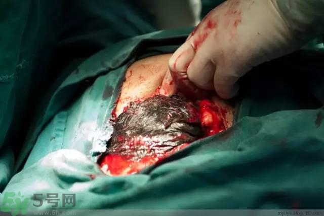 护理最重要的是,按时做护理的重要性 护理最重要的是,按时做护理的重要性