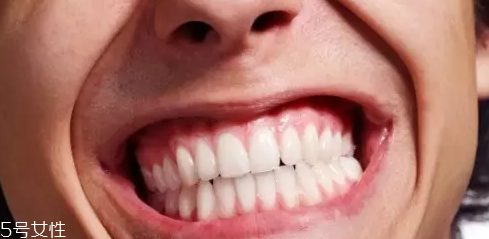 磨牙咋回事,磨牙是什么引起的