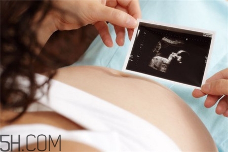 胎儿缺氧怎么办有什么方法,孕妇在什么情况下会导致胎儿缺氧