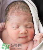 宝宝有奶癣怎么办,宝宝长奶癣的图片 宝宝有奶癣怎么办,宝宝长奶癣的图片