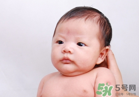 脸上出白色的小白点可以挤出来吗,脸上有小白点能挤出白色分泌物 脸上出白色的小白点可以挤出来吗,脸上有小白点能挤出白色分泌物