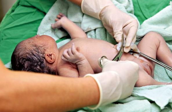 新生儿脐带出血怎么办,新生儿肚脐出血怎么办 新生儿脐带出血怎么办,新生儿肚脐出血怎么办