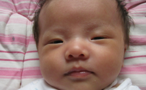 宝宝黄疸怎么办最有效的方法,小宝宝黄疸高怎么办?