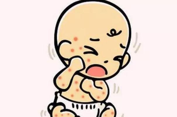 婴儿湿疹是怎么形成的,婴儿的湿疹是怎么引起的?怎么办? 婴儿湿疹是怎么形成的,婴儿的湿疹是怎么引起的?怎么办?