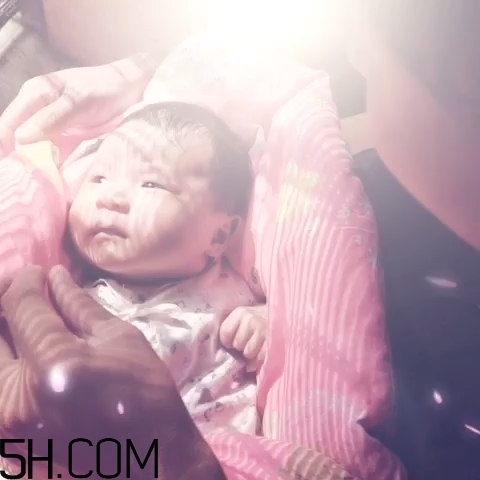 宝宝秃枕头厉害是缺什么原因,小孩子枕秃是怎么回事 宝宝秃枕头厉害是缺什么原因,小孩子枕秃是怎么回事