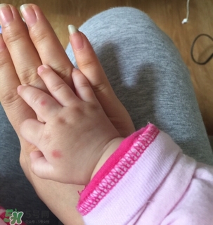 日本叮叮对宝宝有害吗,日本叮叮怎么使用