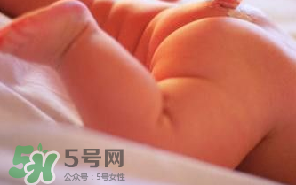 尿布疹快速治愈方法,尿布疹怎么办