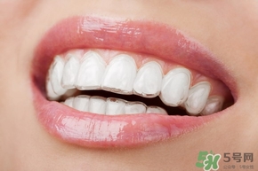 隐适美的原理是什么,隐适美矫正原理