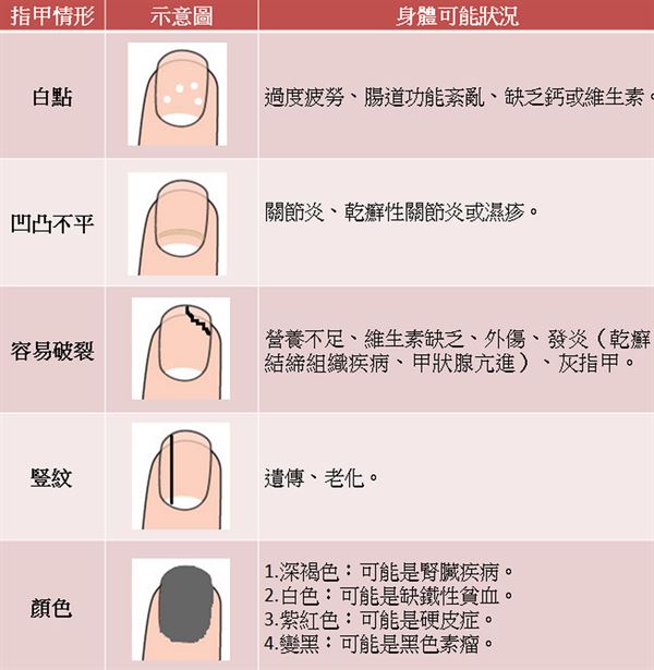 一般来说,健康的指甲是什么颜色的,正常指甲颜色和形状