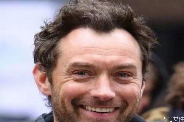 发际线m型会慢慢秃顶吗,天生m型发际线会秃吗