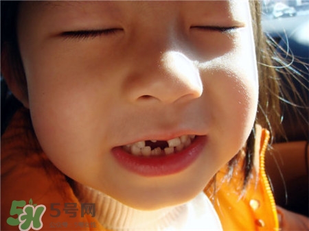 换牙期间牙松动了能不能直接拔掉,孩子换牙可以拔掉吗 换牙期间牙松动了能不能直接拔掉,孩子换牙可以拔掉吗