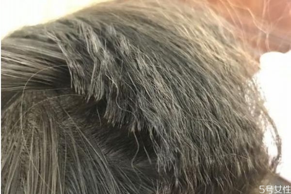 发根烫是什么样子的,发根烫叫什么