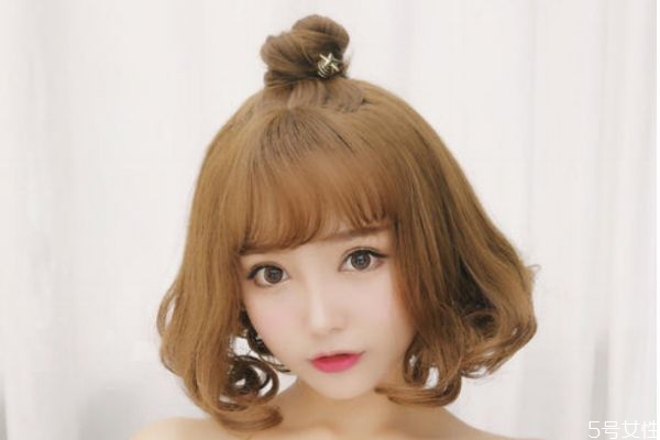 发际线后移是什么意思,发际线后移是怎么造成的