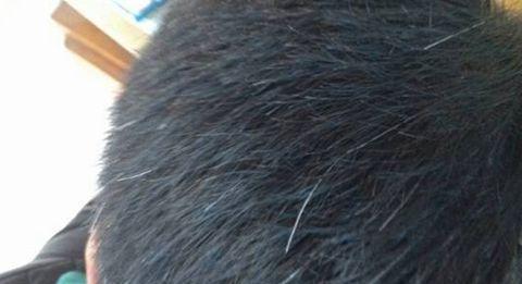 白头发怎么预防,如何防止白发增多