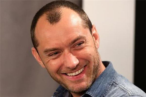 秃顶了留什么发型好,头顶秃适合什么发型