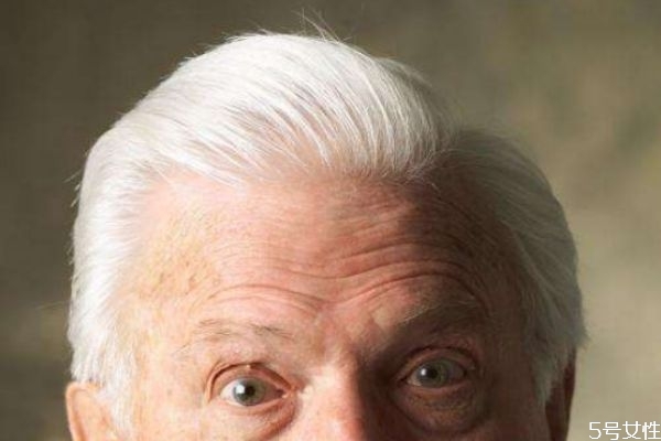 怎样预防白头发,长了白发该怎么办,怎样预防白头发增多