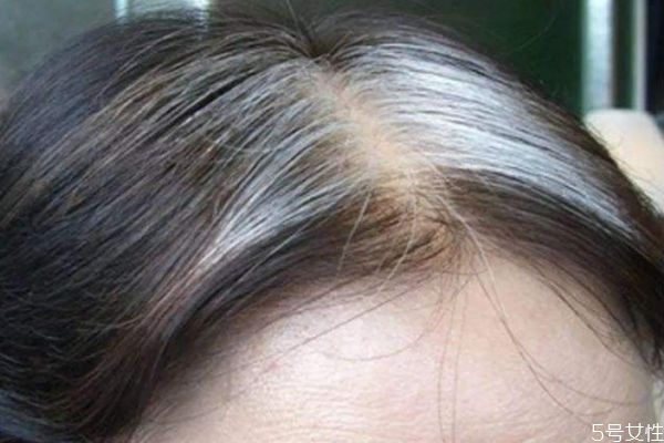 有了白头发是该剪掉还是拔掉,白发拔了好还是不拔好?