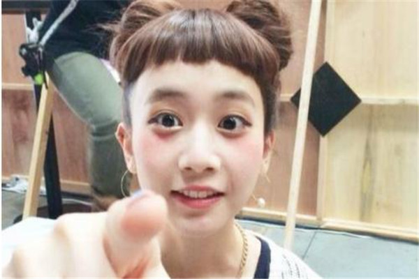 头发老是断怎么办,头发碎发多怎么办