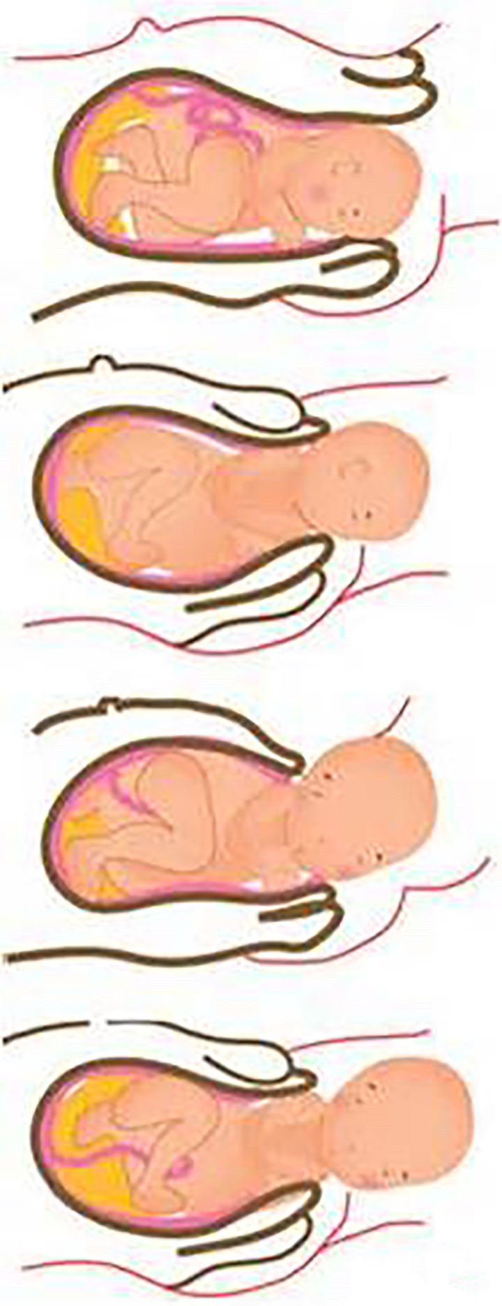 分娩三个产程,三个产程分别是什么