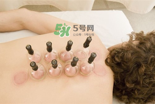 拔罐的好处和功效,拔罐的好处和坏处,多久拔一回