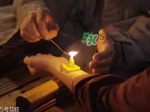 三伏天艾灸疗法好吗,三伏天艾灸疗法