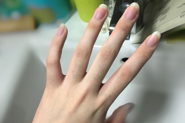 全身皮肤干裂是皮肤病吗,皮肤病 干裂