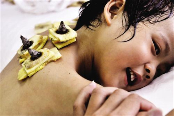 三伏贴起泡了怎么办处理,三伏贴起泡了怎么办?