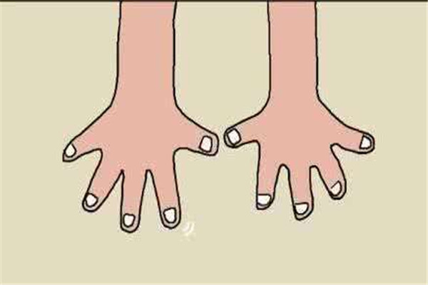 灰指甲怎么形成的原因,怎么会得灰指甲灰指甲的原因