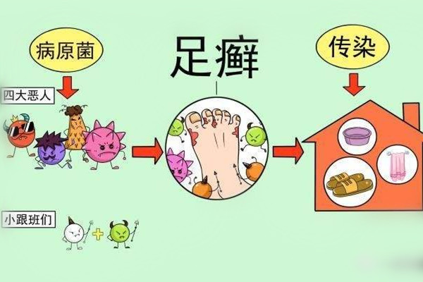 灰指甲的种类及图片,灰指甲有哪几种类型 灰指甲的种类及图片,灰指甲有哪几种类型