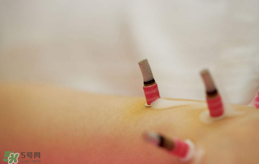 艾灸后皮肤发痒是怎么回事儿,艾灸过后皮肤很痒是什么问题?