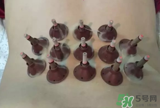 艾灸肚脐的功效和作用,艾灸腹部什么时间最好 艾灸肚脐的功效和作用,艾灸腹部什么时间最好