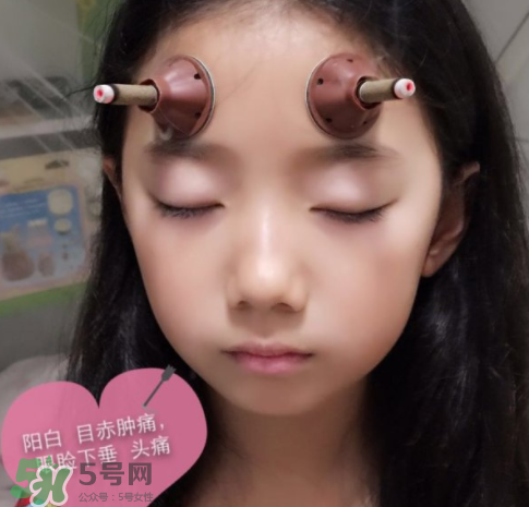 艾灸条可以治咳嗽吗,艾灸能治咳嗽吗