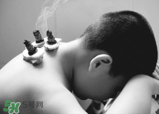 什么人适合做三伏灸,三伏灸是什么