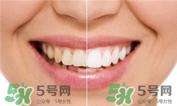 冷光美白是什么意思,冷光美白是什么原理 冷光美白是什么意思,冷光美白是什么原理