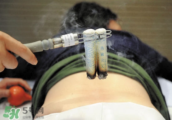 艾灸治疗什么病,艾灸治疗作用