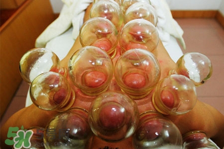 拔罐放血有泡沫怎么回事,拔罐放血时里面有血沫 拔罐放血有泡沫怎么回事,拔罐放血时里面有血沫