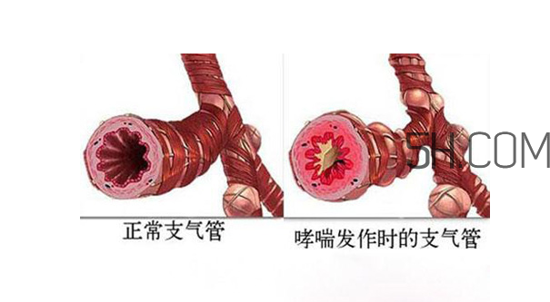 小山眉的面相好吗(小山眉适合什么样脸型)