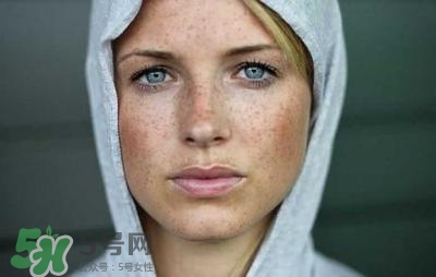 黄褐斑最好的治疗方法是什么?,怎么去黄褐斑最有效的方法