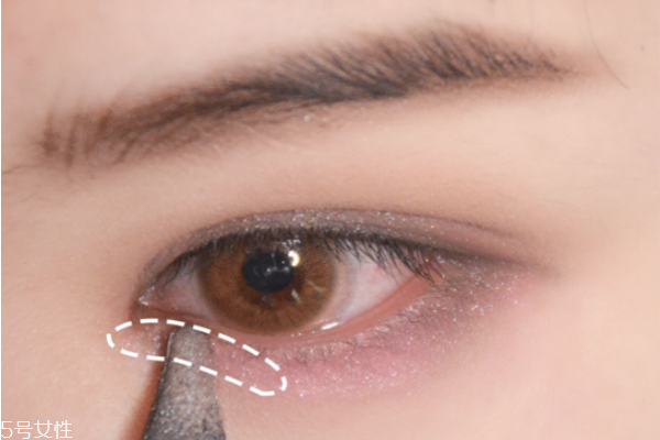 瘦脸针去哪打(瘦脸针哪里打)