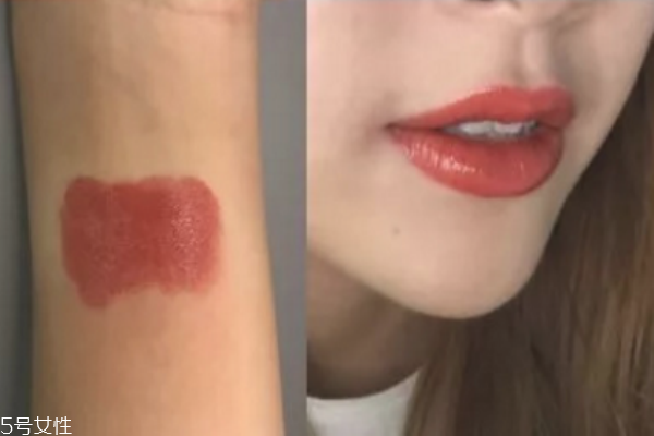 哪种脸型适合打瘦脸针(什么脸型适合打瘦脸针) 哪种脸型适合打瘦脸针(什么脸型适合打瘦脸针)