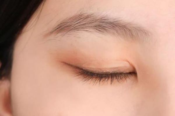 肿眼泡贴什么样的双眼皮贴,肿泡眼用什么双眼皮贴 肿眼泡贴什么样的双眼皮贴,肿泡眼用什么双眼皮贴