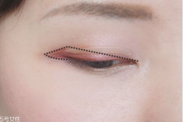 指甲矫正器怎么用,脚指甲矫正器怎么用