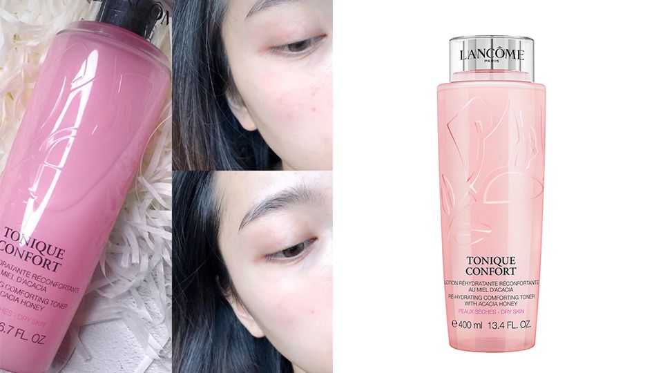 乳晕缩小术的优缺点(乳晕缩小术会留疤) 乳晕缩小术的优缺点(乳晕缩小术会留疤)