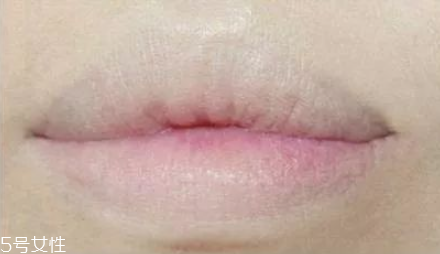 睡觉产生皱纹的原理(睡觉姿势和皱纹有关系吗?)