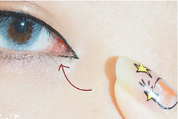 鼻翼缩小常见风险(鼻翼缩小有风险吗)