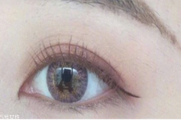 除皱针能保持多久(除皱针打一次能保持多久)