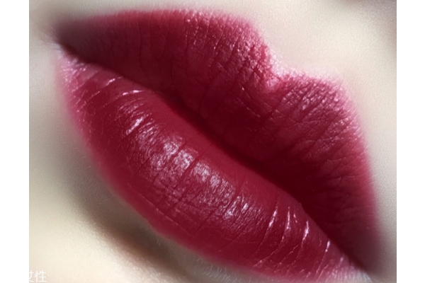 全切双眼皮肉条修复时间(双眼皮全切肉条多久可以恢复)