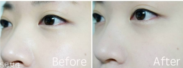 半永久眉毛掉结痂前怎样护理(半永久眉毛掉痂过程)